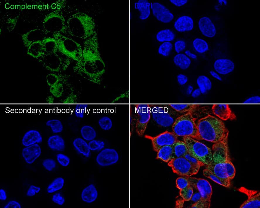 Immunocytochemistry/ Immunofluorescence: Complement C5 Antibody (PSH04-01) [NBP3-32209] - Immunocytochemistry analysis of HepG2 cells labeling Complement C5 with Rabbit anti-Complement C5 antibody (NBP3-32209) at 1/100 dilution. Cells were fixed in 4% paraformaldehyde for 20 minutes at room temperature, permeabilized with 0.1% Triton X-100 in PBS for 5 minutes at room temperature, then blocked with 1% BSA in 10% negative goat serum for 1 hour at room temperature. Cells were then incubated with Rabbit anti-Complement C5 antibody (NBP3-32209) at 1/100 dilution in 1% BSA in PBST overnight at 4 ℃. Goat Anti-Rabbit IgG H&L (iFluor™ 488) was used as the secondary antibody at 1/1,000 dilution. PBS instead of the primary antibody was used as the secondary antibody only control. Nuclear DNA was labelled in blue with DAPI. Beta tubulin (red) was stained at 1/100 dilution overnight at +4℃. Goat Anti-Mouse IgG H&L (iFluor™ 594) was used as the secondary antibody at 1/1,000 dilution.