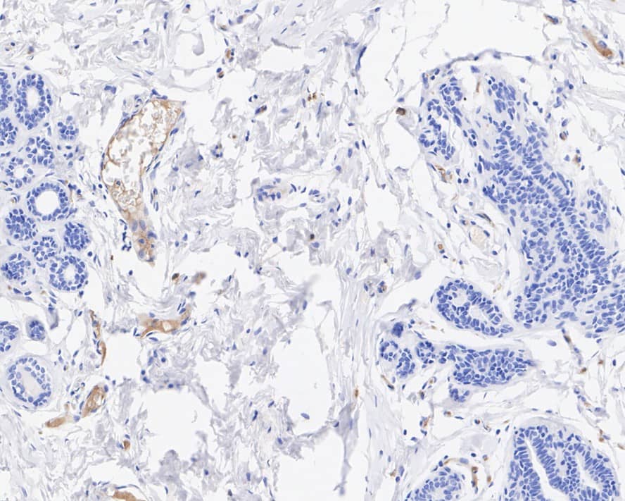 Immunohistochemistry: Complement C5 Antibody (PSH04-01) [NBP3-32209] - Immunohistochemical analysis of paraffin-embedded human breast tissue with Rabbit anti-Complement C5 antibody (NBP3-32209) at 1/200 dilution. The section was pre-treated using heat mediated antigen retrieval with Tris-EDTA buffer (pH 9.0) for 20 minutes. The tissues were blocked in 1% BSA for 20 minutes at room temperature, washed with ddH2O and PBS, and then probed with the primary antibody (NBP3-32209) at 1/200 dilution for 1 hour at room temperature. The detection was performed using an HRP conjugated compact polymer system. DAB was used as the chromogen. Tissues were counterstained with hematoxylin and mounted with DPX.