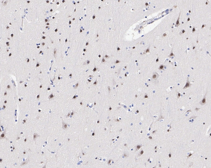 Immunohistochemistry: COUP-TF I/NR2F1 Antibody (JE31-95) [NBP3-32211] - Immunohistochemical analysis of paraffin-embedded human brain tissue with Rabbit anti-COUP-TF I/NR2F1 antibody (NBP3-32211) at 1/1,000 dilution. The section was pre-treated using heat mediated antigen retrieval with sodium citrate buffer (pH 6.0) for 2 minutes. The tissues were blocked in 1% BSA for 20 minutes at room temperature, washed with ddH2O and PBS, and then probed with the primary antibody (NBP3-32211) at 1/1,000 dilution for 1 hour at room temperature. The detection was performed using an HRP conjugated compact polymer system. DAB was used as the chromogen. Tissues were counterstained with hematoxylin and mounted with DPX.