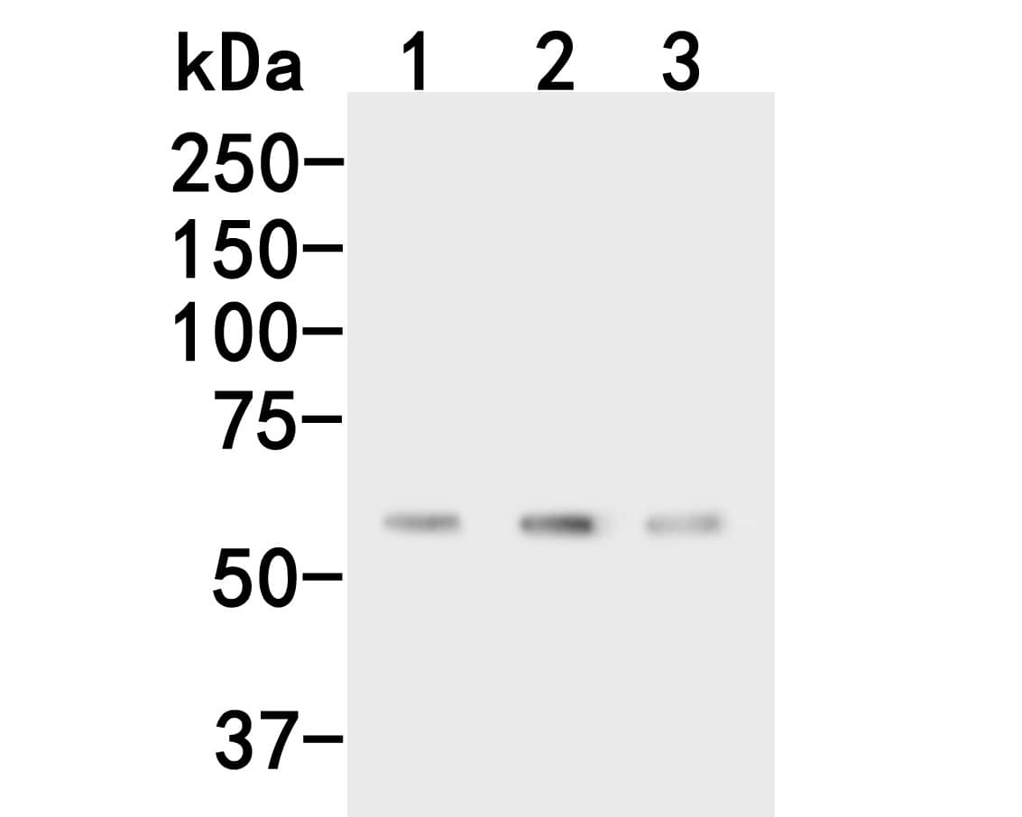 Western Blot CPN1 Antibody