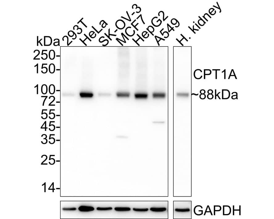 Western Blot: CPT1A Antibody (PSH04-00) [NBP3-32213] - Western blot analysis of CPT1A on different lysates with Rabbit anti-CPT1A antibody (NBP3-32213) at 1/2,000 dilution. Lane 1: 293T cell lysate Lane 2: HeLa cell lysate Lane 3: SK-OV-3 cell lysate Lane 4: MCF7 cell lysate Lane 5: HepG2 cell lysate Lane 6: A549 cell lysate Lane 7: Human kidney tissue lysate Lysates/proteins at 20 ug/Lane. Predicted band size: 88 kDa Observed band size: 88 kDa Exposure time: 30 seconds; 4-20% SDS-PAGE gel. Proteins were transferred to a PVDF membrane and blocked with 5% NFDM/TBST for 1 hour at room temperature. The primary antibody (NBP3-32213) at 1/2,000 dilution was used in 5% NFDM/TBST at 4C overnight. Goat Anti-Rabbit IgG - HRP Secondary Antibody at 1/50,000 dilution was used for 1 hour at room temperature.