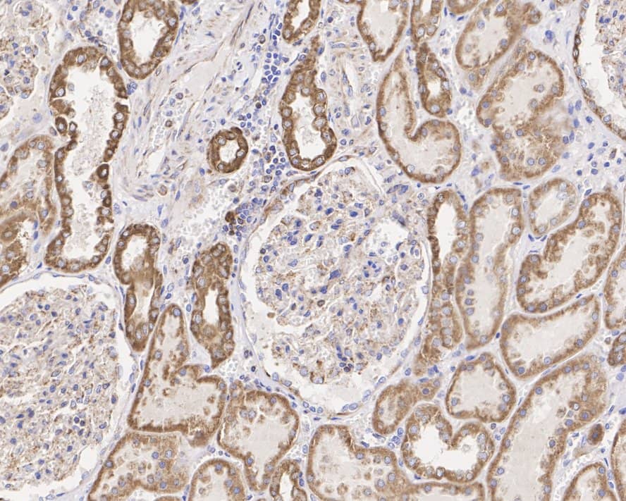 Immunohistochemistry: CPT1A Antibody (PSH04-00) [NBP3-32213] - Immunohistochemical analysis of paraffin-embedded human kidney tissue with Rabbit anti-CPT1A antibody (NBP3-32213) at 1/2,000 dilution. The section was pre-treated using heat mediated antigen retrieval with Tris-EDTA buffer (pH 9.0) for 20 minutes. The tissues were blocked in 1% BSA for 20 minutes at room temperature, washed with ddH2O and PBS, and then probed with the primary antibody (NBP3-32213) at 1/2,000 dilution for 1 hour at room temperature. The detection was performed using an HRP conjugated compact polymer system. DAB was used as the chromogen. Tissues were counterstained with hematoxylin and mounted with DPX.