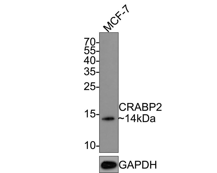 Western Blot: CRABP2 Antibody (JE65-66) [NBP3-32214] - Western blot analysis of CRABP2 on MCF-7 cell lysates with Rabbit anti-CRABP2 antibody (NBP3-32214) at 1/1,000 dilution. Lysates/proteins at 10 ug/Lane. Predicted band size: 16 kDa Observed band size: 14 kDa Exposure time: 2 minutes; 15% SDS-PAGE gel. Proteins were transferred to a PVDF membrane and blocked with 5% NFDM/TBST for 1 hour at room temperature. The primary antibody (NBP3-32214) at 1/1,000 dilution was used in 5% NFDM/TBST at room temperature for 2 hours. Goat Anti-Rabbit IgG - HRP Secondary Antibody at 1:300,000 dilution was used for 1 hour at room temperature.