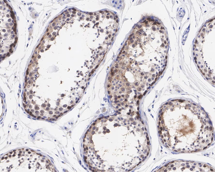 Immunohistochemistry: CRBN Antibody (PSH0-70) [NBP3-32217] - Immunohistochemical analysis of paraffin-embedded human testis tissue with Rabbit anti-CRBN antibody (NBP3-32217) at 1/200 dilution. The section was pre-treated using heat mediated antigen retrieval with sodium citrate buffer (pH 6.0) for 2 minutes. The tissues were blocked in 1% BSA for 20 minutes at room temperature, washed with ddH2O and PBS, and then probed with the primary antibody (NBP3-32217) at 1/200 dilution for 1 hour at room temperature. The detection was performed using an HRP conjugated compact polymer system. DAB was used as the chromogen. Tissues were counterstained with hematoxylin and mounted with DPX.