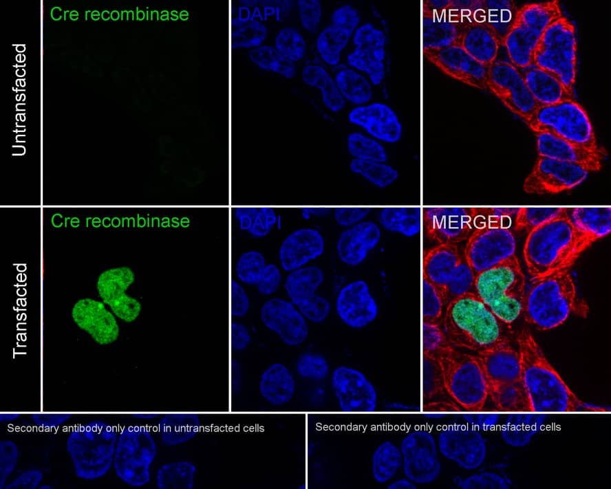 Immunocytochemistry/ Immunofluorescence: Cre Antibody (PSH01-93) [NBP3-32219] - Immunocytochemistry analysis of 293T transfacted with or without Cre cells labeling Cre recombinase with Rabbit anti-Cre antibody (NBP3-32219) at 1/20,000 dilution. Cells were fixed in 4% paraformaldehyde for 20 minutes at room temperature, permeabilized with 0.1% Triton X-100 in PBS for 5 minutes at room temperature, then blocked with 1% BSA in 10% negative goat serum for 1 hour at room temperature. Cells were then incubated with Rabbit anti-Cre antibody (NBP3-32219) at 1/20,000 dilution in 1% BSA in PBST overnight at 4 ℃. Goat Anti-Rabbit IgG H&L (iFluor™ 488) was used as the secondary antibody at 1/1,000 dilution. PBS instead of the primary antibody was used as the secondary antibody only control. Nuclear DNA was labelled in blue with DAPI. Beta tubulin (red) was stained at 1/100 dilution overnight at +4℃. Goat Anti-Mouse IgG H&L (iFluor™ 594) was used as the secondary antibody at 1/1,000 dilution.