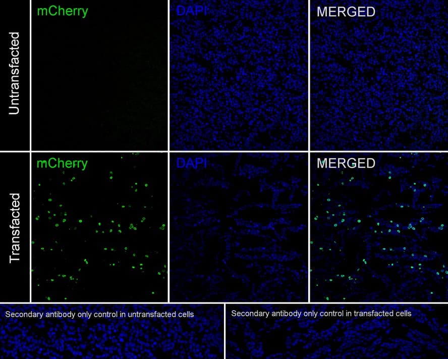 Immunohistochemistry: Cre Antibody (PSH01-93) [NBP3-32219] - Immunofluorescence analysis of paraffin-embedded 293T transfacted with or without Cre cells labeling Cre recombinase with Rabbit anti-Cre antibody (NBP3-32219) at 1/20,000 dilution. The section was pre-treated using heat mediated antigen retrieval with sodium citrate buffer (pH 6.0) for 2 minutes. The tissues were blocked in 10% negative goat serum for 1 hour at room temperature, washed with PBS, and then probed with the primary antibody (NBP3-32219, green) at 1/20,000 dilution overnight at 4 ℃, washed with PBS. Goat Anti-Rabbit IgG H&L (iFluor™ 488) was used as the secondary antibody at 1/1,000 dilution. Nuclei were counterstained with DAPI (blue).