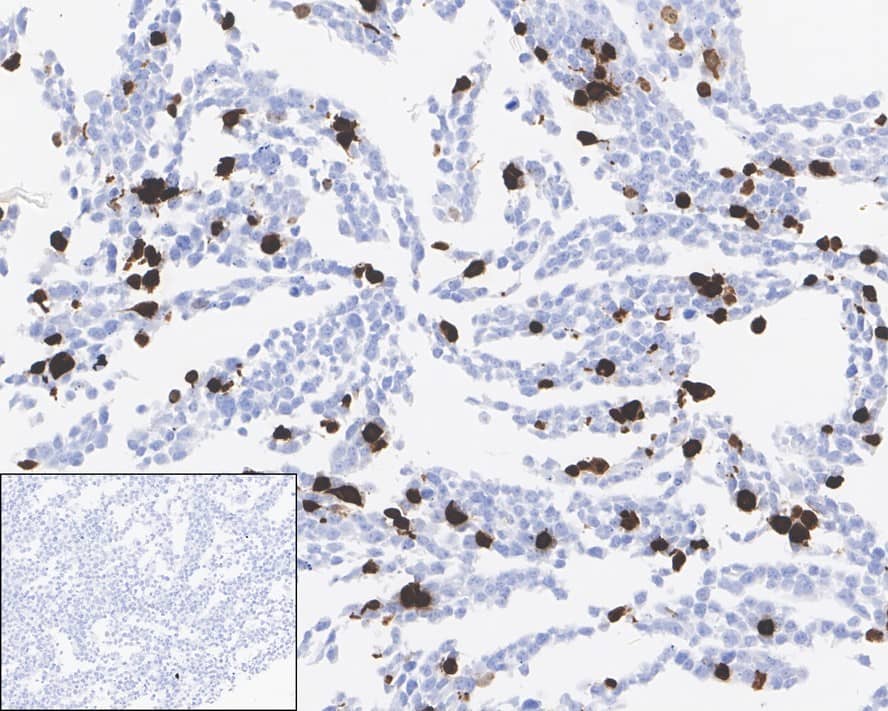 Immunohistochemistry: Cre Antibody (PSH01-93) [NBP3-32219] - Immunohistochemical analysis of paraffin-embedded 293T transfacted with or without Cre cells with Rabbit anti-Cre antibody (NBP3-32219) at 1/10,000 dilution. The section was pre-treated using heat mediated antigen retrieval with sodium citrate buffer (pH 6.0) for 2 minutes. The tissues were blocked in 1% BSA for 20 minutes at room temperature, washed with ddH2O and PBS, and then probed with the primary antibody (NBP3-32219) at 1/10,000 dilution for 1 hour at room temperature. The detection was performed using an HRP conjugated compact polymer system. DAB was used as the chromogen. Tissues were counterstained with hematoxylin and mounted with DPX.