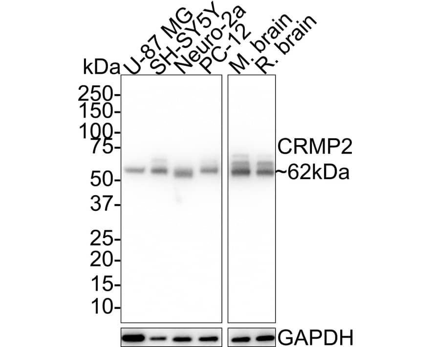 Western Blot: CRMP2 Antibody (JE31-53) [NBP3-32224] - Western blot analysis of CRMP2 on different lysates with Rabbit anti-CRMP2 antibody (NBP3-32224) at 1/1,000 dilution. Lane 1: U-87 MG cell lysate (20 ug/Lane) Lane 2: SH-SY5Y cell lysate (10 ug/Lane) Lane 3: Neuro-2a cell lysate (15 ug/Lane) Lane 4: PC-12 cell lysate (10 ug/Lane) Lane 5: Mouse brain tissue lysate (10 ug/Lane) Lane 6: Rat brain tissue lysate (10 ug/Lane) Predicted band size: 62 kDa Observed band size: 62 kDa Exposure time: 5 seconds; 4-20% SDS-PAGE gel. Proteins were transferred to a PVDF membrane and blocked with 5% NFDM/TBST for 1 hour at room temperature. The primary antibody (NBP3-32224) at 1/1,000 dilution was used in 5% NFDM/TBST at room temperature for 2 hours. Goat Anti-Rabbit IgG - HRP Secondary Antibody at 1:100,000 dilution was used for 1 hour at room temperature.