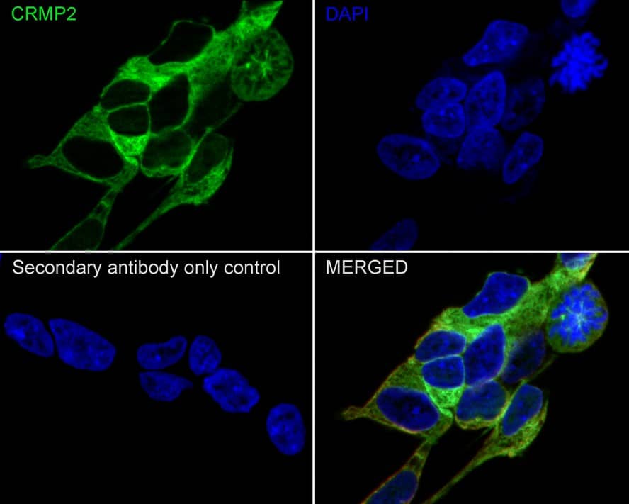 Immunocytochemistry/ Immunofluorescence: CRMP2 Antibody (JE31-53) [NBP3-32224] - Immunocytochemistry analysis of SH-SY5Y cells labeling CRMP2 with Rabbit anti-CRMP2 antibody (NBP3-32224) at 1/100 dilution. Cells were fixed in 4% paraformaldehyde for 20 minutes at room temperature, permeabilized with 0.1% Triton X-100 in PBS for 5 minutes at room temperature, then blocked with 1% BSA in 10% negative goat serum for 1 hour at room temperature. Cells were then incubated with Rabbit anti-CRMP2 antibody (NBP3-32224) at 1/100 dilution in 1% BSA in PBST overnight at 4 ℃. Goat Anti-Rabbit IgG H&L (iFluor™ 488) was used as the secondary antibody at 1/1,000 dilution. PBS instead of the primary antibody was used as the secondary antibody only control. Nuclear DNA was labelled in blue with DAPI. Beta tubulin (red) was stained at 1/100 dilution overnight at +4℃. Goat Anti-Mouse IgG H&L (iFluor™ 594) was used as the secondary antibody at 1/1,000 dilution.