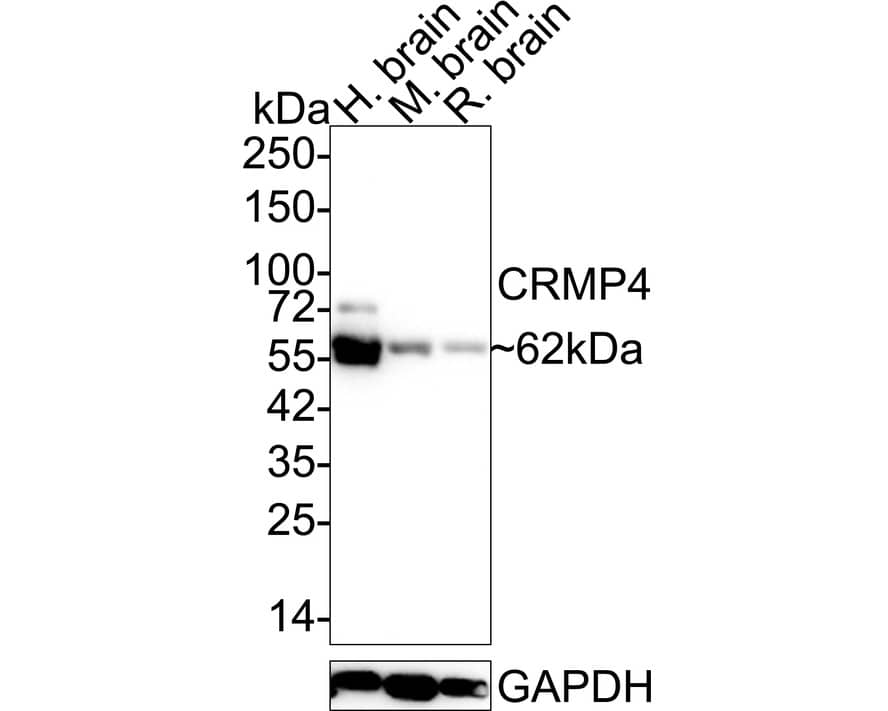 Western blot analysis on different lysates with NBP3-32225 at 1/1,000 dilution. Lane 1: Human brain tissue lysate Lane 2: Mouse brain tissue lysate Lane 3: Rat brain tissue lysate Lysates/proteins at 30 µg/Lane. Predicted band size: 62 kDa Observed band size: 62 kDa Exposure time: 10 seconds;  4-20% SDS-PAGE gel. Proteins were transferred to a PVDF membrane and blocked with 5% NFDM/TBST for 1 hour at room temperature. NBP3-32225 at 1/1,000 dilution was used in 5% NFDM/TBST at 4℃ overnight. Goat Anti-Rabbit IgG [HRP] Secondary Antibody at 1/50,000 dilution was used for 1 hour at room temperature.