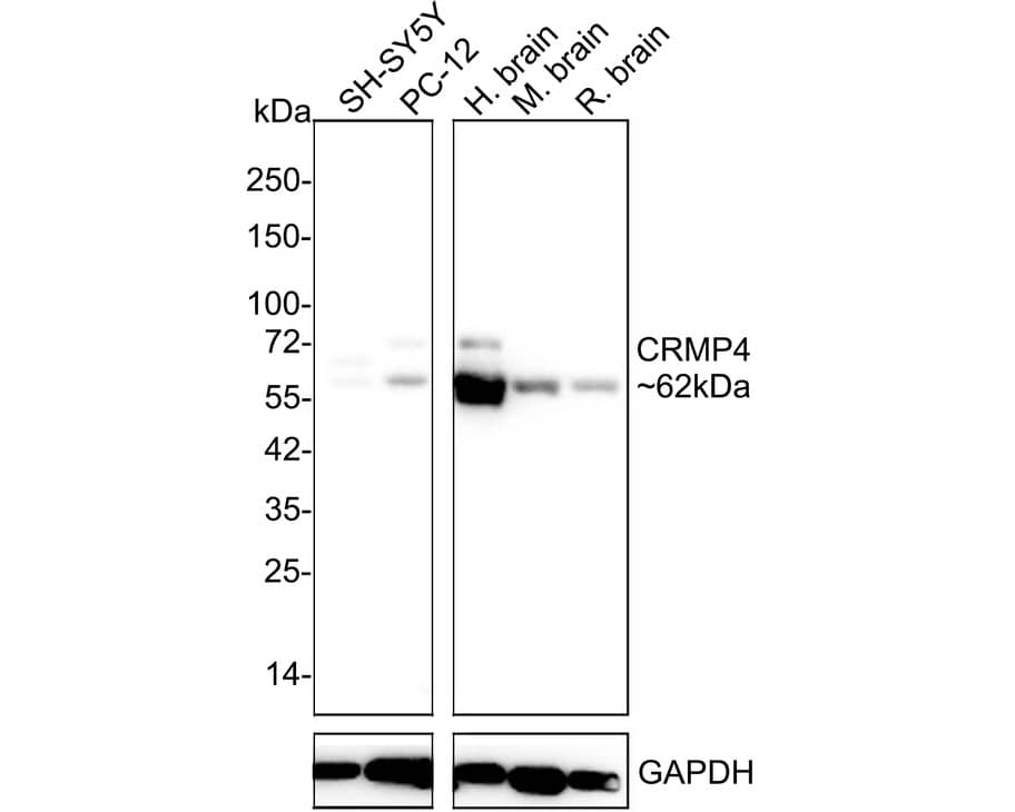 Western Blot: CRMP4 Antibody (JE55-99) [NBP3-32225] - Western blot analysis of CRMP4 on different lysates with Rabbit anti-CRMP4 antibody (NBP3-32225) at 1/1,000 dilution. Lane 1: SH-SY5Y cell lysate Lane 2: PC-12 cell lysate Lane 3: Human brain tissue lysate Lane 4: Mouse brain tissue lysate Lane 5: Rat brain tissue lysate Cell lysates/proteins at 20 ug/Lane. Tissue lysates/proteins at 30 ug/Lane. Predicted band size: 62 kDa Observed band size: 62 kDa Exposure time: 10 seconds; 4-20% SDS-PAGE gel. Proteins were transferred to a PVDF membrane and blocked with 5% NFDM/TBST for 1 hour at room temperature. The primary antibody (NBP3-32225) at 1/1,000 dilution was used in 5% NFDM/TBST at 4C overnight. Goat Anti-Rabbit IgG - HRP Secondary Antibody at 1/50,000 dilution was used for 1 hour at room temperature.