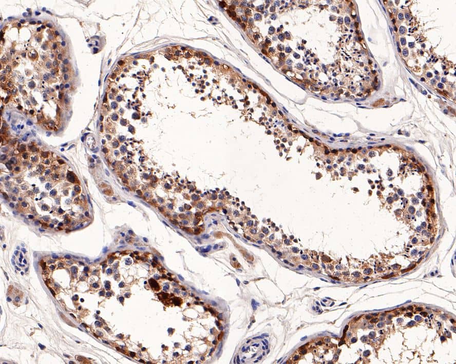 Immunohistochemistry: CTAG1B Antibody (PD00-87) [NBP3-32229] - Immunohistochemical analysis of paraffin-embedded human testis tissue with Rabbit anti-CTAG1B antibody (NBP3-32229) at 1/2,000 dilution. The section was pre-treated using heat mediated antigen retrieval with Tris-EDTA buffer (pH 9.0) for 20 minutes. The tissues were blocked in 1% BSA for 20 minutes at room temperature, washed with ddH2O and PBS, and then probed with the primary antibody (NBP3-32229) at 1/2,000 dilution for 1 hour at room temperature. The detection was performed using an HRP conjugated compact polymer system. DAB was used as the chromogen. Tissues were counterstained with hematoxylin and mounted with DPX.