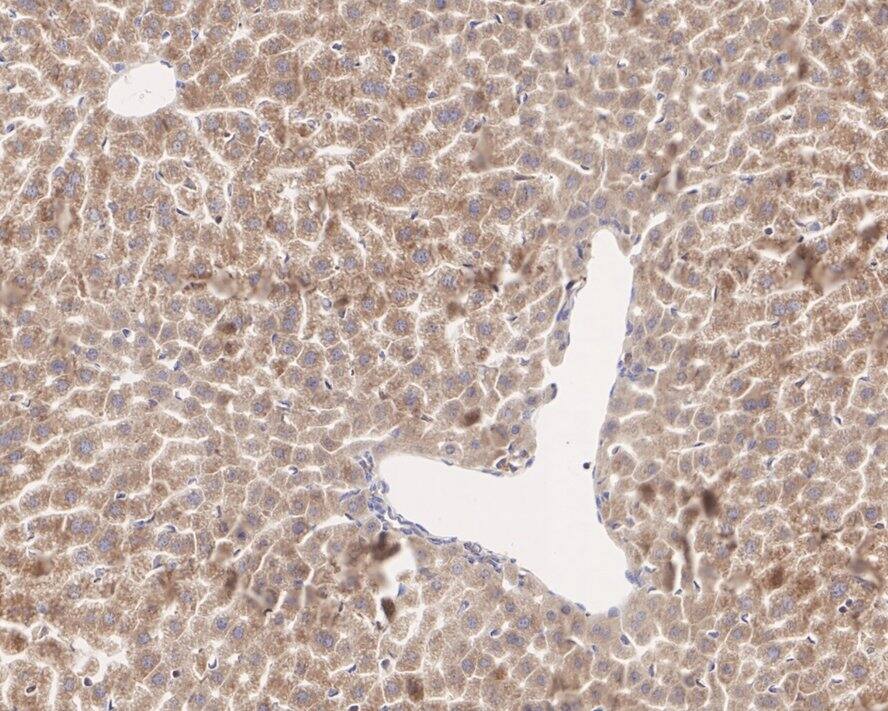 Immunohistochemistry: CTU2 Antibody (PSH04-05) [NBP3-32231] - Immunohistochemical analysis of paraffin-embedded mouse liver tissue with Rabbit anti-CTU2 antibody (NBP3-32231) at 1/200 dilution. The section was pre-treated using heat mediated antigen retrieval with Tris-EDTA buffer (pH 9.0) for 20 minutes. The tissues were blocked in 1% BSA for 20 minutes at room temperature, washed with ddH2O and PBS, and then probed with the primary antibody (NBP3-32231) at 1/200 dilution for 1 hour at room temperature. The detection was performed using an HRP conjugated compact polymer system. DAB was used as the chromogen. Tissues were counterstained with hematoxylin and mounted with DPX.
