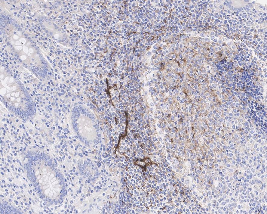 Immunohistochemistry: CXCL13/BLC/BCA-1 Antibody (PSH04-34) [NBP3-32234] - Immunohistochemical analysis of paraffin-embedded human appendix tissue with Rabbit anti-CXCL13/BLC/BCA-1 antibody (NBP3-32234) at 1/100 dilution. The section was pre-treated using heat mediated antigen retrieval with Tris-EDTA buffer (pH 9.0) for 20 minutes. The tissues were blocked in 1% BSA for 20 minutes at room temperature, washed with ddH2O and PBS, and then probed with the primary antibody (NBP3-32234) at 1/100 dilution for 1 hour at room temperature. The detection was performed using an HRP conjugated compact polymer system. DAB was used as the chromogen. Tissues were counterstained with hematoxylin and mounted with DPX.