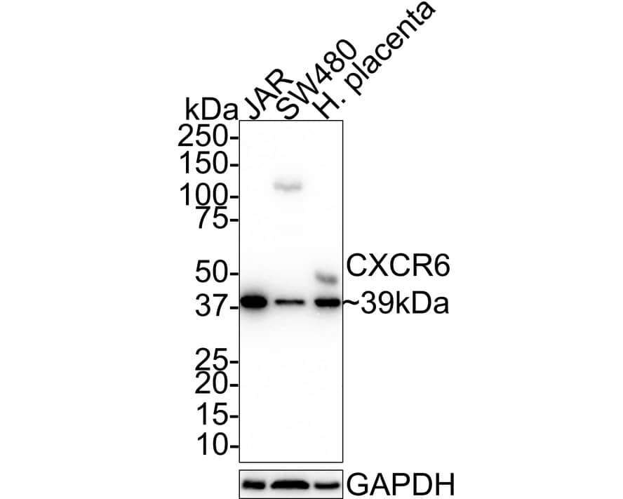 Western Blot: CXCR6 Antibody (JE66-40) [NBP3-32235] - Western blot analysis of CXCR6 on different lysates with Rabbit anti-CXCR6 antibody (NBP3-32235) at 1/1,000 dilution. Lane 1: JAR cell lysate (10 ug/Lane) Lane 2: SW480 cell lysate (20 ug/Lane) Lane 3: Human placenta tissue lysate (30 ug/Lane) Predicted band size: 39 kDa Observed band size: 39 kDa Exposure time: 5 minutes; 4-20% SDS-PAGE gel. Proteins were transferred to a PVDF membrane and blocked with 5% NFDM/TBST for 1 hour at room temperature. The primary antibody (NBP3-32235) at 1/1,000 dilution was used in 5% NFDM/TBST at room temperature for 2 hours. Goat Anti-Rabbit IgG - HRP Secondary Antibody at 1:100,000 dilution was used for 1 hour at room temperature.