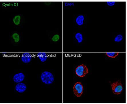 Immunocytochemistry/ Immunofluorescence: Cyclin D1 Antibody (PD01-64) [NBP3-32236] - Immunocytochemistry analysis of Neuro-2a cells labeling Cyclin D1 with Rabbit anti-Cyclin D1 antibody (NBP3-32236) at 1/2,000 dilution. Cells were fixed in 4% paraformaldehyde for 20 minutes at room temperature, permeabilized with 0.1% Triton X-100 in PBS for 5 minutes at room temperature, then blocked with 1% BSA in 10% negative goat serum for 1 hour at room temperature. Cells were then incubated with Rabbit anti-Cyclin D1 antibody at 1/2,000 dilution in 1% BSA in PBST overnight at 4 ℃. Goat Anti-Rabbit IgG H&L (iFluor™ 488) was used as the secondary antibody at 1/1,000 dilution. PBS instead of the primary antibody was used as the secondary antibody only control. Nuclear DNA was labelled in blue with DAPI. Beta tubulin (red) was stained at 1/100 dilution overnight at +4℃. Goat Anti-Mouse IgG H&L (iFluor™ 594) was used as the secondary antibody at 1/1,000 dilution.