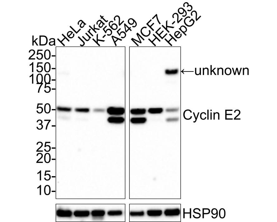 Western blot analysis on different lysates with NBP3-32237 at 1/1,000 dilution. Lane 1: HeLa cell lysate Lane 2: Jurkat cell lysate Lane 3: K-562 cell lysate Lane 4: A549 cell lysate Lane 5: MCF7 cell lysate Lane 6: HEK-293 cell lysate Lane 7: HepG2 cell lysate Lysates/proteins at 20 µg/Lane. Predicted band size: 47 kDa Observed band size: 51/47 kDa Exposure time: 2 minutes; 4-20% SDS-PAGE gel. Proteins were transferred to a PVDF membrane and blocked with 5% NFDM/TBST for 1 hour at room temperature. NBP3-32237 at 1/1,000 dilution was used in 5% NFDM/TBST at room temperature for 2 hours. Goat anti-Mouse IgG [HRP] at 1:150,000 dilution was used for 1 hour at room temperature.