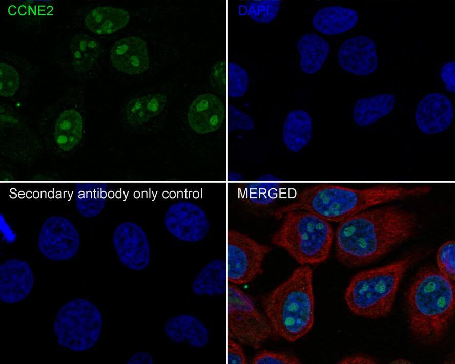 Immunocytochemistry/ Immunofluorescence: Cyclin E2 Antibody (40-89-R) [NBP3-32237] - Immunocytochemistry analysis of HeLa cells labeling Cyclin E2 with Mouse anti-Cyclin E2 antibody (NBP3-32237) at 1/100 dilution. Cells were fixed in 4% paraformaldehyde for 30 minutes, permeabilized with 0.05% Triton X-100 in PBS for 20 minutes, and then blocked with 2% negative goat serum for 30 minutes at room temperature. Cells were then incubated with Mouse anti-Cyclin E2 antibody (NBP3-32237) at 1/100 dilution in 2% negative goat serum overnight at 4 ℃. Goat Anti-Mouse IgG H&L (iFluor™ 488) was used as the secondary antibody at 1/1,000 dilution. Nuclear DNA was labelled in blue with DAPI. beta Tubulin (red) was stained at 1/100 dilution overnight at +4℃. Goat Anti-Rabbit IgG H&L (iFluor™ 594) were used as the secondary antibody at 1/1,000 dilution.