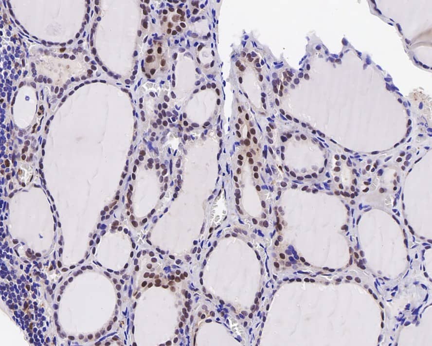 Immunohistochemistry: Cyclin E2 Antibody (40-89-R) [NBP3-32237] - Immunohistochemical analysis of paraffin-embedded human thyroid tissue with Mouse anti-Cyclin E2 antibody (NBP3-32237) at 1/1,000 dilution. The section was pre-treated using heat mediated antigen retrieval with sodium citrate buffer (pH 6.0) for 2 minutes. The tissues were blocked in 1% BSA for 20 minutes at room temperature, washed with ddH2O and PBS, and then probed with the primary antibody (NBP3-32237) at 1/1,000 dilution for 1 hour at room temperature. The detection was performed using an HRP conjugated compact polymer system. DAB was used as the chromogen. Tissues were counterstained with hematoxylin and mounted with DPX.