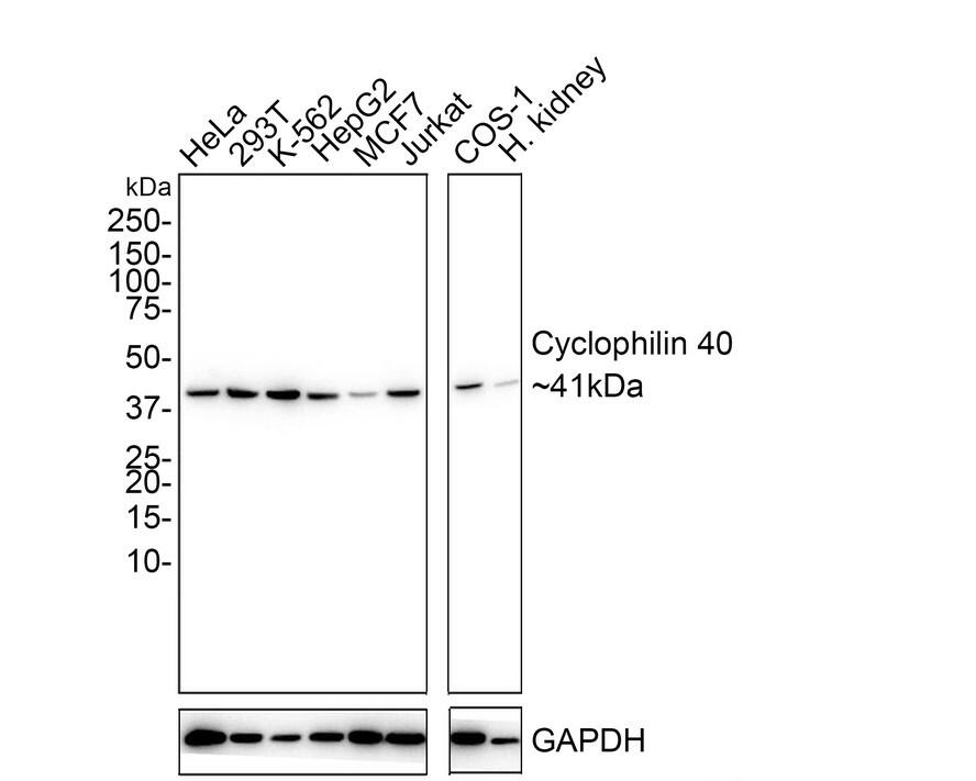 Western blot analysis on different lysates with NBP3-32238 at 1/1,000 dilution. Lane 1: HeLa cell lysate Lane 2: 293T cell lysate Lane 3: K-562 cell lysate Lane 4: HepG2 cell lysate Lane 5: MCF7 cell lysate Lane 6: Jurkat cell lysate Lane 7: COS-1 cell lysate Lane 8: Human liver tissue lysate Lysates/proteins at 30 µg/Lane. Predicted band size: 41 kDa Observed band size: 41 kDa Exposure time: 1 minutes 2 seconds; 4-20% SDS-PAGE gel. Proteins were transferred to a PVDF membrane and blocked with 5% NFDM/TBST for 1 hour at room temperature. NBP3-32238 at 1/1,000 dilution was used in 5% NFDM/TBST at 4℃ overnight. Goat Anti-Rabbit IgG [HRP] Secondary Antibody at 1/50,000 dilution was used for 1 hour at room temperature.