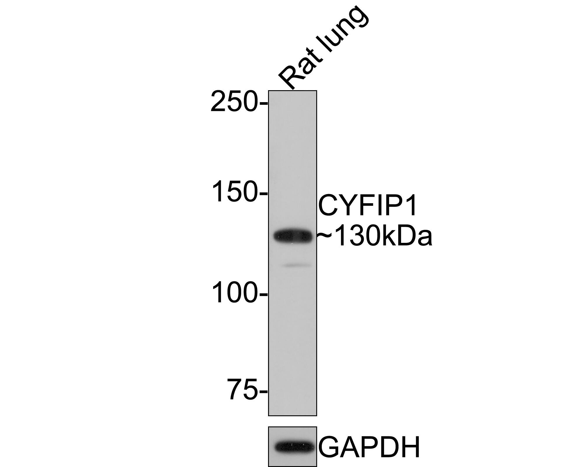Western Blot CYFIP1 Antibody (JE64-11)