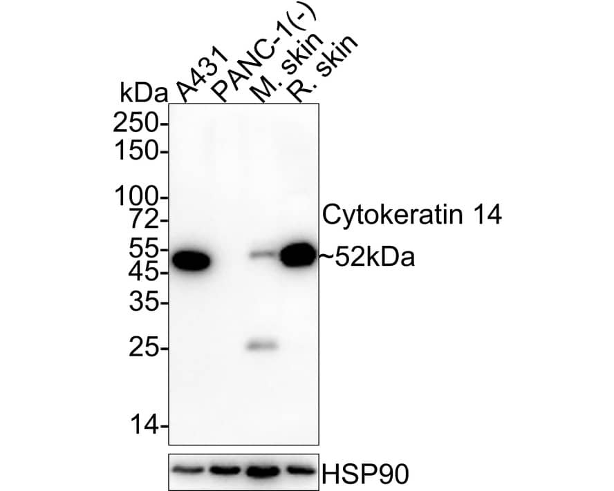 Western blot analysis on different lysates with NBP3-32243 at 1/1,000 dilution. Lane 1: A431 cell lysate (20 µg/Lane) Lane 2: PANC-1 cell lysate (negative) (20 µg/Lane) Lane 3: Mouse skin tissue lysate (40 µg/Lane) Lane 4: Rat skin tissue lysate (40 µg/Lane) Predicted band size: 52 kDa Observed band size: 52 kDa Exposure time: 1 minute; 4-20% SDS-PAGE gel. Proteins were transferred to a PVDF membrane and blocked with 5% NFDM/TBST for 1 hour at room temperature. NBP3-32243 at 1/1,000 dilution was used in 5% NFDM/TBST at 4℃ overnight. Goat anti-Mouse IgG [HRP] at 1/50,000 dilution was used for 1 hour at room temperature.