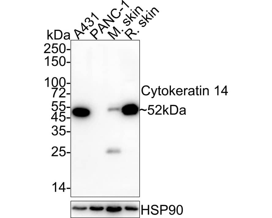 Western Blot: Cytokeratin 14 Antibody (A2C10-R) [NBP3-32243] - Western blot analysis of Cytokeratin 14 on different lysates with Mouse anti-Cytokeratin 14 antibody (NBP3-32243) at 1/1,000 dilution. Lane 1: A431 cell lysate (20 ug/Lane) Lane 2: PANC-1 cell lysate (negative) (20 ug/Lane) Lane 3: Mouse skin tissue lysate (40 ug/Lane) Lane 4: Rat skin tissue lysate (40 ug/Lane) Predicted band size: 52 kDa Observed band size: 52 kDa Exposure time: 1 minute; 4-20% SDS-PAGE gel. Proteins were transferred to a PVDF membrane and blocked with 5% NFDM/TBST for 1 hour at room temperature. The primary antibody (NBP3-32243) at 1/1,000 dilution was used in 5% NFDM/TBST at 4C overnight. Goat Anti-Mouse IgG - HRP Secondary Antibody at 1/50,000 dilution was used for 1 hour at room temperature.