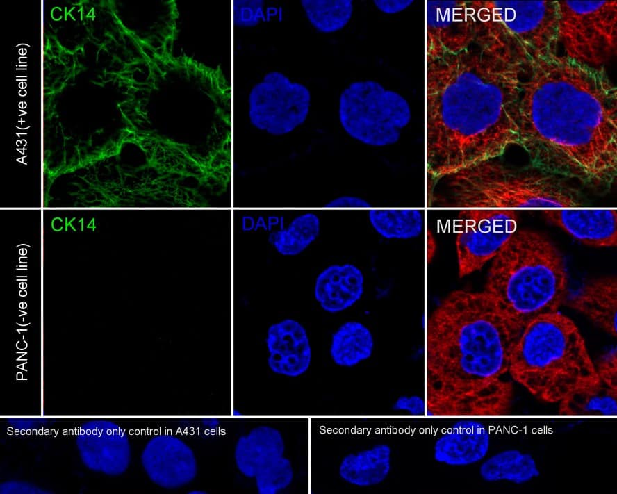 Immunocytochemistry/ Immunofluorescence: Cytokeratin 14 Antibody (A2C10-R) [NBP3-32243] - Immunocytochemistry analysis of A431 (positive) and PANC-1 (negative) labeling Cytokeratin 14 with Mouse anti-Cytokeratin 14 antibody (NBP3-32243) at 1/100 dilution. Cells were fixed in 4% paraformaldehyde for 20 minutes at room temperature, permeabilized with 0.1% Triton X-100 in PBS for 5 minutes at room temperature, then blocked with 1% BSA in 10% negative goat serum for 1 hour at room temperature. Cells were then incubated with Mouse anti-Cytokeratin 14 antibody (NBP3-32243) at 1/100 dilution in 1% BSA in PBST overnight at 4 ℃. Goat Anti-Mouse IgG H&L (iFluor™ 488) was used as the secondary antibody at 1/1,000 dilution. PBS instead of the primary antibody was used as the secondary antibody only control. Nuclear DNA was labelled in blue with DAPI. beta Tubulin (red) was stained at 1/100 dilution overnight at +4℃. Goat Anti-Rabbit IgG H&L (iFluor™ 594) were used as the secondary antibody at 1/1,000 dilution.