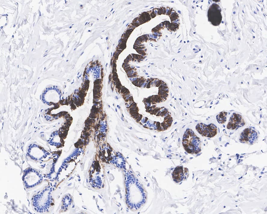 Immunohistochemistry: Cytokeratin 14 Antibody (A2C10-R) [NBP3-32243] - Immunohistochemical analysis of paraffin-embedded human breast tissue with Mouse anti-Cytokeratin 14 antibody (NBP3-32243) at 1/1,000 dilution. The section was pre-treated using heat mediated antigen retrieval with Tris-EDTA buffer (pH 9.0) for 20 minutes. The tissues were blocked in 1% BSA for 20 minutes at room temperature, washed with ddH2O and PBS, and then probed with the primary antibody (NBP3-32243) at 1/1,000 dilution for 1 hour at room temperature. The detection was performed using an HRP conjugated compact polymer system. DAB was used as the chromogen. Tissues were counterstained with hematoxylin and mounted with DPX.