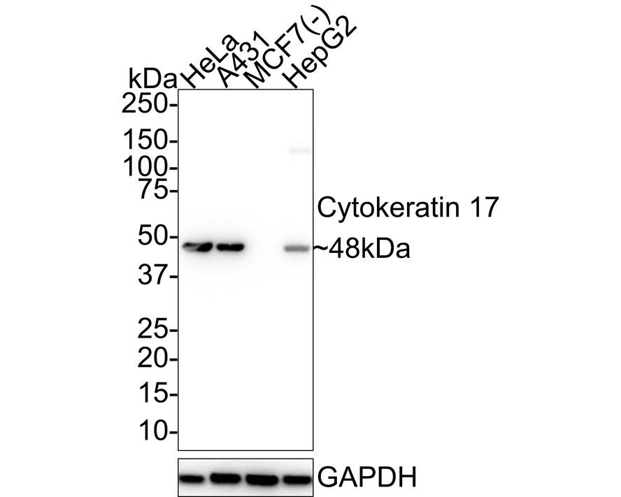 Western blot analysis on different lysates with NBP3-32244 at 1/1,000 dilution. Lane 1: HeLa cell lysate Lane 2: A431 cell lysate Lane 3: MCF7 cell lysate (negative) Lane 4: HepG2 cell lysate Lysates/proteins at 20 µg/Lane. Predicted band size: 48 kDa Observed band size: 48 kDa Exposure time: 5 seconds; 4-20% SDS-PAGE gel. Proteins were transferred to a PVDF membrane and blocked with 5% NFDM/TBST for 1 hour at room temperature. NBP3-32244 at 1/1,000 dilution was used in 5% NFDM/TBST at 4℃ overnight. Goat anti-Mouse IgG [HRP] at 1/50,000 dilution was used for 1 hour at room temperature.