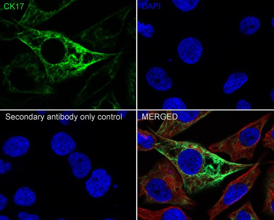 Immunocytochemistry/ Immunofluorescence: Cytokeratin 17 Antibody (A2B10-R) [NBP3-32244] - Immunocytochemistry analysis of HeLa cells labeling Cytokeratin 17 with Mouse anti-Cytokeratin 17 antibody (NBP3-32244) at 1/100 dilution. Cells were fixed in 4% paraformaldehyde for 20 minutes at room temperature, permeabilized with 0.1% Triton X-100 in PBS for 5 minutes at room temperature, then blocked with 1% BSA in 10% negative goat serum for 1 hour at room temperature. Cells were then incubated with Mouse anti-Cytokeratin 17 antibody (NBP3-32244) at 1/100 dilution in 1% BSA in PBST overnight at 4 ℃. Goat Anti-Mouse IgG H&L (iFluor™ 488) was used as the secondary antibody at 1/1,000 dilution. PBS instead of the primary antibody was used as the secondary antibody only control. Nuclear DNA was labelled in blue with DAPI. beta Tubulin (red) was stained at 1/100 dilution overnight at +4℃. Goat Anti-Rabbit IgG H&L (iFluor™ 594) were used as the secondary antibody at 1/1,000 dilution.