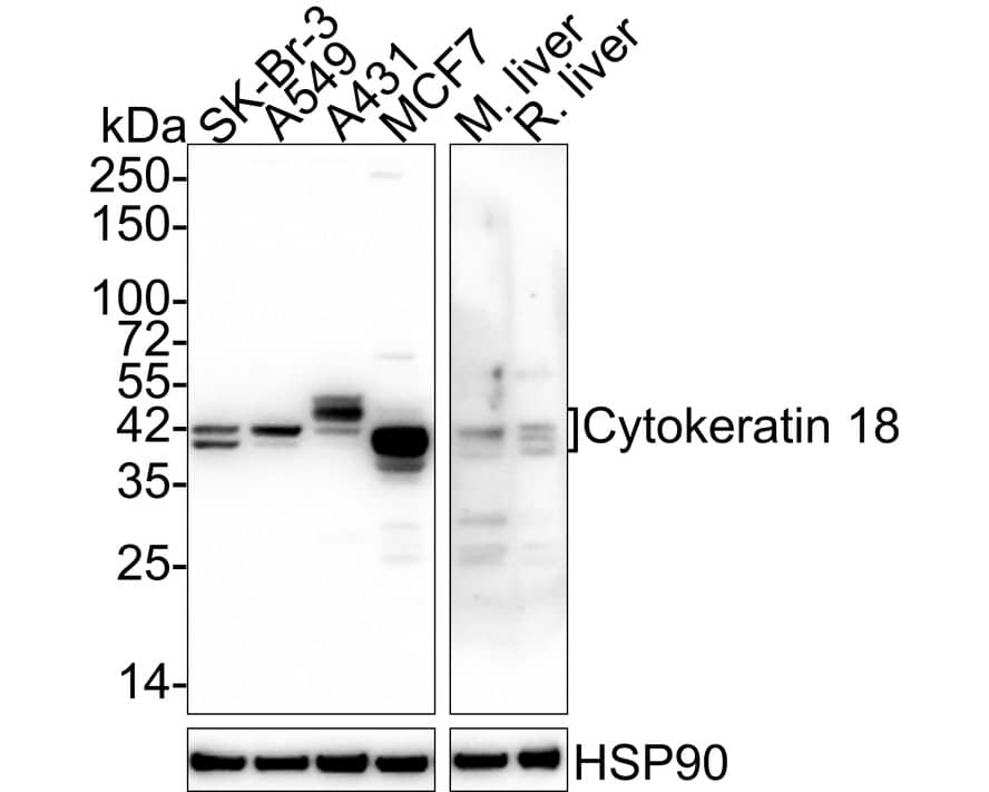 Western Blot: Cytokeratin 18 Antibody (A4B3-R) [NBP3-32245] - Western blot analysis of Cytokeratin 18 on different lysates with Mouse anti-Cytokeratin 18 antibody (NBP3-32245) at 1/1,000 dilution. Lane 1: SK-Br-3 cell lysate (20 ug/Lane) Lane 2: A549 cell lysate (20 ug/Lane) Lane 3: A431 cell lysate (20 ug/Lane) Lane 4: MCF7 cell lysate (20 ug/Lane) Lane 5: Mouse liver tissue lysate (40 ug/Lane) Lane 6: Rat liver tissue lysate (40 ug/Lane) Predicted band size: 48 kDa Observed band size: 40-50 kDa Exposure time: Lane 1-4: 11 seconds; Lane 5-6: 2 minutes 24 seconds; 4-20% SDS-PAGE gel. Proteins were transferred to a PVDF membrane and blocked with 5% NFDM/TBST for 1 hour at room temperature. The primary antibody (NBP3-32245) at 1/1,000 dilution was used in 5% NFDM/TBST at 4C overnight. Goat Anti-Mouse IgG - HRP Secondary Antibody at 1/50,000 dilution was used for 1 hour at room temperature.