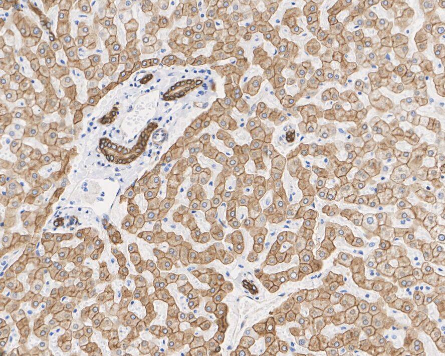 Immunohistochemistry: Cytokeratin 18 Antibody (A4B3-R) [NBP3-32245] - Immunohistochemical analysis of paraffin-embedded human liver tissue with Mouse anti-Cytokeratin 18 antibody (NBP3-32245) at 1/2,000 dilution. The section was pre-treated using heat mediated antigen retrieval with Tris-EDTA buffer (pH 9.0) for 20 minutes. The tissues were blocked in 1% BSA for 20 minutes at room temperature, washed with ddH2O and PBS, and then probed with the primary antibody (NBP3-32245) at 1/2,000 dilution for 1 hour at room temperature. The detection was performed using an HRP conjugated compact polymer system. DAB was used as the chromogen. Tissues were counterstained with hematoxylin and mounted with DPX.