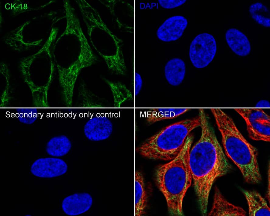 Immunocytochemistry/ Immunofluorescence: Cytokeratin 18 Antibody (6-19-R) [NBP3-32246] - Immunocytochemistry analysis of HeLa cells labeling Cytokeratin 18 with Mouse anti-Cytokeratin 18 antibody (NBP3-32246) at 1/100 dilution. Cells were fixed in 4% paraformaldehyde for 20 minutes at room temperature, permeabilized with 0.1% Triton X-100 in PBS for 5 minutes at room temperature, then blocked with 1% BSA in 10% negative goat serum for 1 hour at room temperature. Cells were then incubated with Mouse anti-Cytokeratin 18 antibody (NBP3-32246) at 1/100 dilution in 1% BSA in PBST overnight at 4 ℃. Goat Anti-Mouse IgG H&L (iFluor™ 488) was used as the secondary antibody at 1/1,000 dilution. PBS instead of the primary antibody was used as the secondary antibody only control. Nuclear DNA was labelled in blue with DAPI. beta Tubulin (red) was stained at 1/100 dilution overnight at +4℃. Goat Anti-Rabbit IgG H&L (iFluor™ 594) were used as the secondary antibody at 1/1,000 dilution.