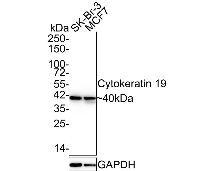 Western Blot: Cytokeratin 19 Antibody (A3D1-R) [NBP3-32247] - Western blot analysis of Cytokeratin 19 on different lysates with Mouse anti-Cytokeratin 19 antibody (NBP3-32247) at 1/1,000 dilution. Lane 1: SK-Br-3 cell lysate Lane 2: MCF7 cell lysate Lysates/proteins at 20 ug/Lane. Predicted band size: 44 kDa Observed band size: 40 kDa Exposure time: 24 seconds; 4-20% SDS-PAGE gel. Proteins were transferred to a PVDF membrane and blocked with 5% NFDM/TBST for 1 hour at room temperature. The primary antibody (NBP3-32247) at 1/1,000 dilution was used in 5% NFDM/TBST at 4C overnight. Goat Anti-Mouse IgG - HRP Secondary Antibody at 1/50,000 dilution was used for 1 hour at room temperature.