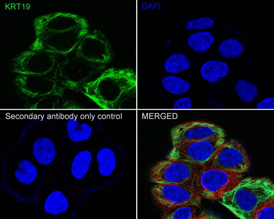 Immunocytochemistry/ Immunofluorescence: Cytokeratin 19 Antibody (A3D1-R) [NBP3-32247] - Immunocytochemistry analysis of MCF7 cells labeling Cytokeratin 19 with Mouse anti-Cytokeratin 19 antibody (NBP3-32247) at 1/200 dilution. Cells were fixed in 4% paraformaldehyde for 20 minutes at room temperature, permeabilized with 0.1% Triton X-100 in PBS for 5 minutes at room temperature, then blocked with 1% BSA in 10% negative goat serum for 1 hour at room temperature. Cells were then incubated with Mouse anti-Cytokeratin 19 antibody (NBP3-32247) at 1/200 dilution in 1% BSA in PBST overnight at 4 ℃. Goat Anti-Mouse IgG H&L (iFluor™ 488) was used as the secondary antibody at 1/1,000 dilution. PBS instead of the primary antibody was used as the secondary antibody only control. Nuclear DNA was labelled in blue with DAPI. beta Tubulin (red) was stained at 1/100 dilution overnight at +4℃. Goat Anti-Rabbit IgG H&L (iFluor™ 594) were used as the secondary antibody at 1/1,000 dilution.
