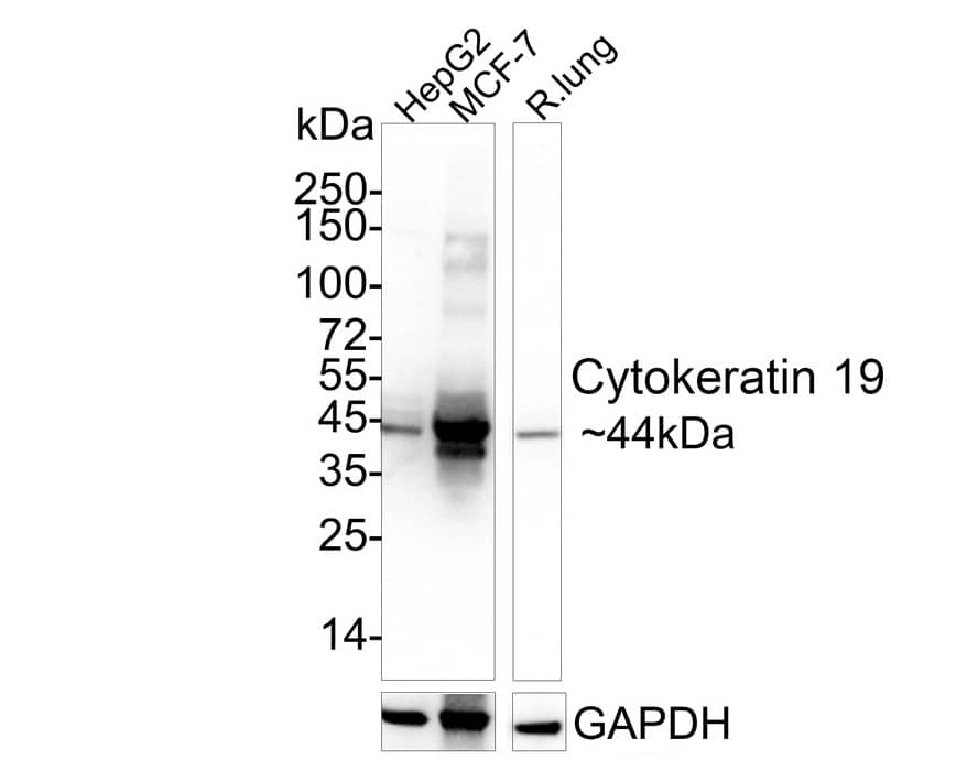 Western blot analysis on different lysates with NBP3-32248 at 1/2,000 dilution. Lane 1: HepG2 cell lysate Lane 2: MCF-7 cell lysate Lane 3: Rat lung tissue lysate Lysates/proteins at 20 µg/Lane. Predicted band size: 44 kDa Observed band size: 44 kDa Exposure time: 9 seconds;  4-20% SDS-PAGE gel. Proteins were transferred to a PVDF membrane and blocked with 5% NFDM/TBST for 1 hour at room temperature. NBP3-32248 at 1/2,000 dilution was used in 5% NFDM/TBST at 4℃ overnight. Goat Anti-Rabbit IgG [HRP] Secondary Antibody at 1/50,000 dilution was used for 1 hour at room temperature.