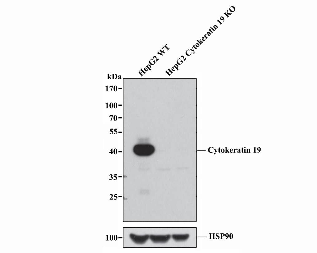 Western Blot: Cytokeratin 19 Antibody (SA30-06) [NBP3-32248] - All lanes: Western blot analysis of Cytokeratin 19 with anti-Cytokeratin 19 antibody [SA30-06] (NBP3-32248) at 1:5,000 dilution. Lane 1: Wild-type HepG2 whole cell lysate (20 ug). Lane 2/3: Cytokeratin 19 knockout HepG2 whole cell lysate (20 ug). NBP3-32248 was shown to specifically react with Cytokeratin 19 in wild-type HepG2 cells. No band was observed when Cytokeratin 19 knockout samples were tested. Wild-type and Cytokeratin 19 knockout samples were subjected to SDS-PAGE. Proteins were transferred to a PVDF membrane and blocked with 5% NFDM in TBST for 1 hour at room temperature. The primary Anti-Cytokeratin 19 Antibody (ET1601-6, 1/5,000) and anti-HSP90 antibody (ET1605-56, 1/10,000) were used in 5% BSA at room temperature for 2 hours. Goat Anti-Rabbit IgG H&L (HRP) Secondary Antibody (HA1001) at 1:200,000 dilution was used for 1 hour at room temperature.