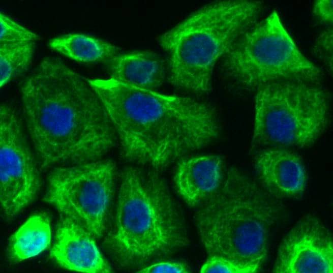 Immunocytochemistry/ Immunofluorescence: Cytokeratin 19 Antibody (SA30-06) [NBP3-32248] - ICC staining of Cytokeratin 19 in AGS cells (green). Formalin fixed cells were permeabilized with 0.1% Triton X-100 in TBS for 10 minutes at room temperature and blocked with 1% Blocker BSA for 15 minutes at room temperature. Cells were probed with the primary antibody (NBP3-32248, 1/100) for 1 hour at room temperature, washed with PBS. Alexa Fluor®488 Goat anti-Rabbit IgG was used as the secondary antibody at 1/1,000 dilution. The nuclear counter stain is DAPI (blue).