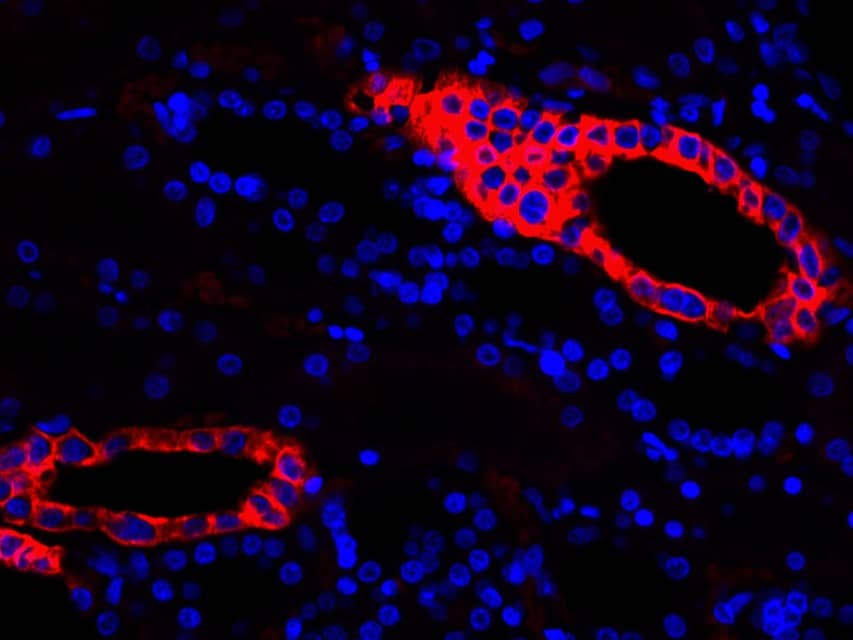 Immunohistochemistry: Cytokeratin 19 Antibody (SA30-06) [NBP3-32248] - Immunofluorescence analysis of paraffin-embedded human kidney tissue labeling Cytokeratin 19 (NBP3-32248). The section was pre-treated using heat mediated antigen retrieval with Tris-EDTA buffer (pH 9.0) for 20 minutes. The tissues were blocked in 10% negative goat serum for 1 hour at room temperature, washed with PBS. And then probed with the primary antibodies Cytokeratin 19 (NBP3-32248, red) at 1/500 dilution at +4℃ overnight, washed with PBS. Goat Anti-Rabbit IgG H&L (iFluor™ 594) was used as the secondary antibodies at 1/1,000 dilution. Nuclei were counterstained with DAPI (blue).