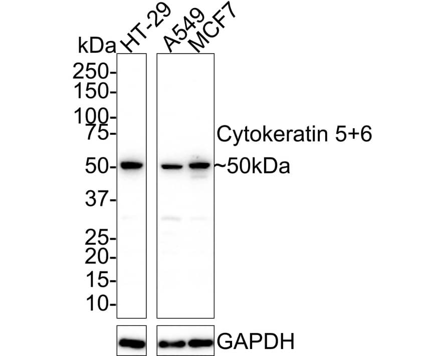 Western Blot: Cytokeratin 5/6 Antibody (A2B2-R) [NBP3-32250] - Western blot analysis of Cytokeratin 5/6 on different lysates with Mouse anti-Cytokeratin 5/6 antibody (NBP3-32250) at 1/1,000 dilution. Lane 1: HT-29 cell lysate Lane 2: A549 cell lysate Lane 3: MCF7 cell lysate Lysates/proteins at 20 ug/Lane. Predicted band size: 60/62 kDa Observed band size: 50 kDa Exposure time: 3 minutes; 4-20% SDS-PAGE gel. Proteins were transferred to a PVDF membrane and blocked with 5% NFDM/TBST for 1 hour at room temperature. The primary antibody (NBP3-32250) at 1/1,000 dilution was used in 5% NFDM/TBST at 4C overnight. Goat Anti-Mouse IgG - HRP Secondary Antibody at 1/50,000 dilution was used for 1 hour at room temperature.