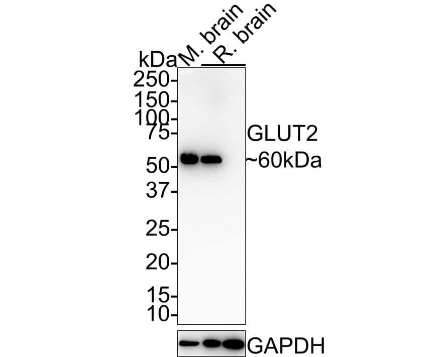 Western blot analysis on different lysates with NBP3-32252 at 1/1,000 dilution. Lane 1: Mouse brain tissue lysate (hot lysis) Lane 2: Rat brain tissue lysate (hot lysis) Lane 3: Rat brain tissue lysate (RIPA lysis) Lysates/proteins at 40 µg/Lane. Predicted band size: 60 kDa Observed band size: 60 kDa Exposure time: 1 minute 40 seconds; 4-20% SDS-PAGE gel. Proteins were transferred to a PVDF membrane and blocked with 5% NFDM/TBST for 1 hour at room temperature. NBP3-32252 at 1/1,000 dilution was used in 5% NFDM/TBST at room temperature for 2 hours. Goat Anti-Rabbit IgG [HRP] Secondary Antibody at 1:100,000 dilution was used for 1 hour at room temperature.