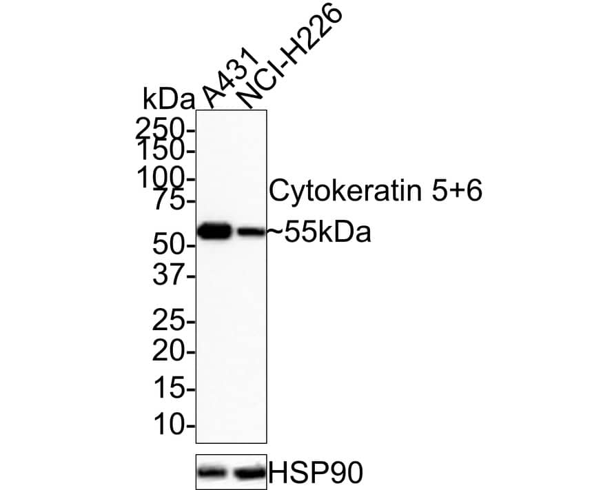 Western Blot: Cytokeratin 5/6 Antibody (PSH0-68) [NBP3-32252] - Western blot analysis of Cytokeratin 5/6 on different lysates with Rabbit anti-Cytokeratin 5/6 antibody (NBP3-32252) at 1/1,000 dilution. Lane 1: A431 cell lysate Lane 2: NCI-H226 cell lysate Lysates/proteins at 10 ug/Lane. Predicted band size: 60 kDa Observed band size: 55 kDa Exposure time: 1 minute; 4-20% SDS-PAGE gel. Proteins were transferred to a PVDF membrane and blocked with 5% NFDM/TBST for 1 hour at room temperature. The primary antibody (NBP3-32252) at 1/1,000 dilution was used in 5% NFDM/TBST at room temperature for 2 hours. Goat Anti-Rabbit IgG - HRP Secondary Antibody at 1:100,000 dilution was used for 1 hour at room temperature.