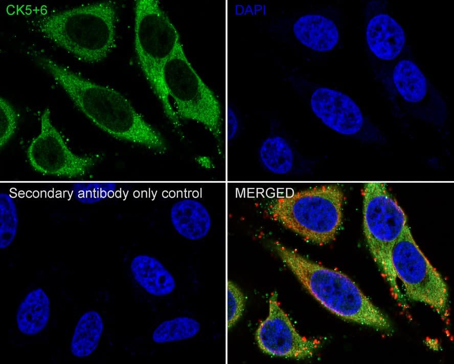 Immunocytochemistry/ Immunofluorescence: Cytokeratin 5/6 Antibody (PSH0-68) [NBP3-32252] - Immunocytochemistry analysis of HeLa cells labeling Cytokeratin 5/6 with Rabbit anti-Cytokeratin 5/6 antibody (NBP3-32252) at 1/100 dilution. Cells were fixed in 4% paraformaldehyde for 10 minutes at 37 ℃, permeabilized with 0.05% Triton X-100 in PBS for 20 minutes, and then blocked with 2% negative goat serum for 30 minutes at room temperature. Cells were then incubated with Rabbit anti-Cytokeratin 5/6 antibody (NBP3-32252) at 1/100 dilution in 2% negative goat serum overnight at 4 ℃. Goat Anti-Rabbit IgG H&L (iFluor™ 488) was used as the secondary antibody at 1/1,000 dilution. Nuclear DNA was labelled in blue with DAPI. Beta tubulin (red) was stained at 1/200 dilution overnight at +4℃. Goat Anti-Mouse IgG H&L (iFluor™ 594) was used as the secondary antibody at 1/1,000 dilution.