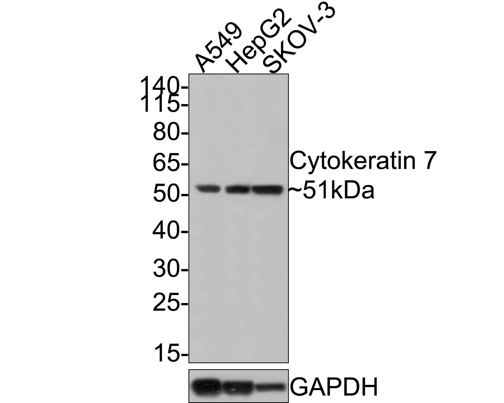 Western Blot: Cytokeratin 7 Antibody (3-G3-D8-R) [NBP3-32253] - Western blot analysis of Cytokeratin 7 on different lysates with Mouse anti-Cytokeratin 7 antibody (NBP3-32253) at 1/1,000 dilution. Lane 1: A549 cell lysate Lane 2: HepG2 cell lysate Lane 3: SKOV-3 cell lysate Lysates/proteins at 10 ug/Lane. Predicted band size: 51 kDa Observed band size: 51 kDa Exposure time: 30 seconds; 4-20% SDS-PAGE gel. Proteins were transferred to a PVDF membrane and blocked with 5% NFDM/TBST for 1 hour at room temperature. The primary antibody (NBP3-32253) at 1/1,000 dilution was used in 5% NFDM/TBST at room temperature for 2 hours. Goat Anti-Mouse IgG - HRP Secondary Antibody at 1:100,000 dilution was used for 1 hour at room temperature.