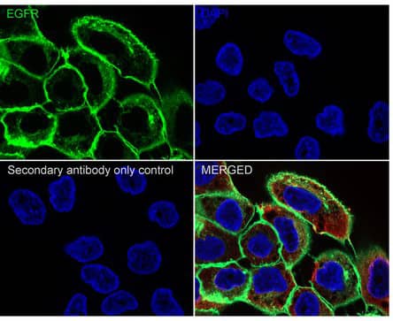Immunocytochemistry/ Immunofluorescence: EGFR Antibody (PD00-75) [NBP3-32255] - Immunocytochemistry analysis of A431 cells labeling EGFR with Rabbit anti-EGFR antibody (NBP3-32255) at 1/500 dilution. Cells were fixed in 4% paraformaldehyde for 20 minutes at room temperature, permeabilized with 0.1% Triton X-100 in PBS for 5 minutes at room temperature, then blocked with 1% BSA in 10% negative goat serum for 1 hour at room temperature. Cells were then incubated with Rabbit anti-EGFR antibody at 1/500 dilution in 1% BSA in PBST overnight at 4 ℃. Goat Anti-Rabbit IgG H&L (iFluor™ 488) was used as the secondary antibody at 1/1,000 dilution. PBS instead of the primary antibody was used as the secondary antibody only control. Nuclear DNA was labelled in blue with DAPI. Beta tubulin (red) was stained at 1/100 dilution overnight at +4℃. Goat Anti-Mouse IgG H&L (iFluor™ 594) was used as the secondary antibody at 1/1,000 dilution.