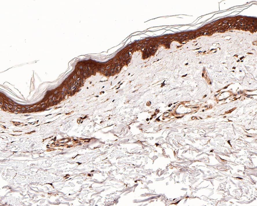Immunohistochemistry: EGFR Antibody (PD00-75) [NBP3-32255] - Immunohistochemical analysis of paraffin-embedded human skin tissue with Rabbit anti-EGFR antibody (NBP3-32255) at 1/800 dilution. The section was pre-treated using heat mediated antigen retrieval with Tris-EDTA buffer (pH 9.0) for 20 minutes. The tissues were blocked in 1% BSA for 20 minutes at room temperature, washed with ddH2O and PBS, and then probed with the primary antibody (NBP3-32255) at 1/800 dilution for 1 hour at room temperature. The detection was performed using an HRP conjugated compact polymer system. DAB was used as the chromogen. Tissues were counterstained with hematoxylin and mounted with DPX.
