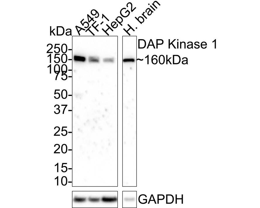 Western blot analysis on different lysates with NBP3-32256 at 1/2,000 dilution. Lane 1: A549 cell lysate (30 µg/Lane) Lane 2: TF-1 cell lysate (30 µg/Lane) Lane 3: HepG2 cell lysate (30 µg/Lane) Lane 4: Human brain tissue lysate (30 µg/Lane) Predicted band size: 160 kDa Observed band size: 160 kDa Exposure time: 2 minutes;  4-20% SDS-PAGE gel. Proteins were transferred to a PVDF membrane and blocked with 5% NFDM/TBST for 1 hour at room temperature. NBP3-32256 at 1/2,000 dilution was used in 5% NFDM/TBST at room temperature for 2 hours. Goat anti-Mouse IgG [HRP] at 1/100,000 dilution was used for 1 hour at room temperature.