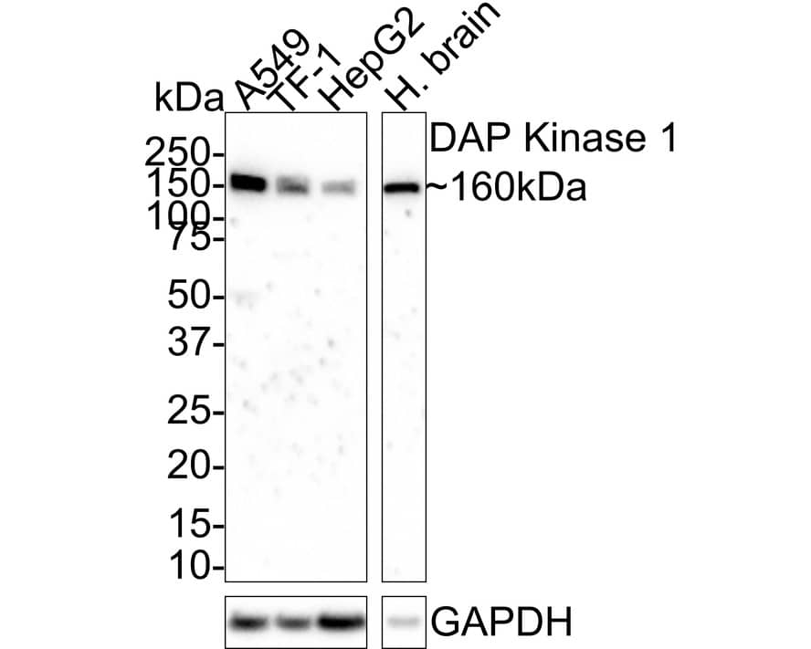 Western Blot: DAP Kinase 1 Antibody (12B2-R) [NBP3-32256] - Western blot analysis of DAP Kinase 1 on different lysates with Mouse anti-DAP Kinase 1 antibody (NBP3-32256) at 1/2,000 dilution. Lane 1: A549 cell lysate Lane 2: TF-1 cell lysate Lane 3: HepG2 cell lysate Lane 4: Human brain tissue lysate Lysates/proteins at 30 ug/Lane. Predicted band size: 160 kDa Observed band size: 160 kDa Exposure time: 2 minutes; 4-20% SDS-PAGE gel. Proteins were transferred to a PVDF membrane and blocked with 5% NFDM/TBST for 1 hour at room temperature. The primary antibody (NBP3-32256) at 1/2,000 dilution was used in 5% NFDM/TBST at room temperature for 2 hours. Goat Anti-Mouse IgG - HRP Secondary Antibody at 1:100,000 dilution was used for 1 hour at room temperature.