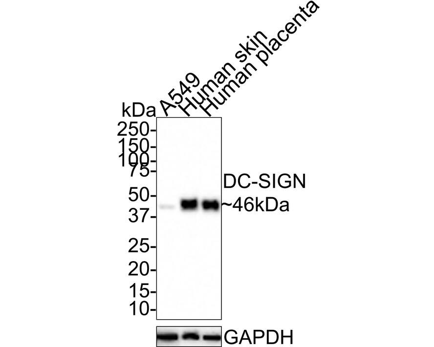 Western Blot: DC-SIGN/CD209 Antibody (JE31-24) [NBP3-32258] - Western blot analysis of DC-SIGN/CD209 on different lysates with Rabbit anti-DC-SIGN/CD209 antibody (NBP3-32258) at 1/1,000 dilution. Lane 1: A549 cell lysate (15 ug/Lane) Lane 2: Human skin tissue lysate (30 ug/Lane) Lane 3: Human placenta tissue lysate (30 ug/Lane) Predicted band size: 46 kDa Observed band size: 46 kDa Exposure time: 3 minutes; 4-20% SDS-PAGE gel. Proteins were transferred to a PVDF membrane and blocked with 5% NFDM/TBST for 1 hour at room temperature. The primary antibody (NBP3-32258) at 1/1,000 dilution was used in 5% NFDM/TBST at room temperature for 2 hours. Goat Anti-Rabbit IgG - HRP Secondary Antibody at 1:100,000 dilution was used for 1 hour at room temperature.